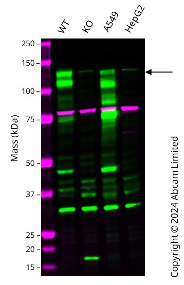 Human EPHB2 knockout HCT116 cell line