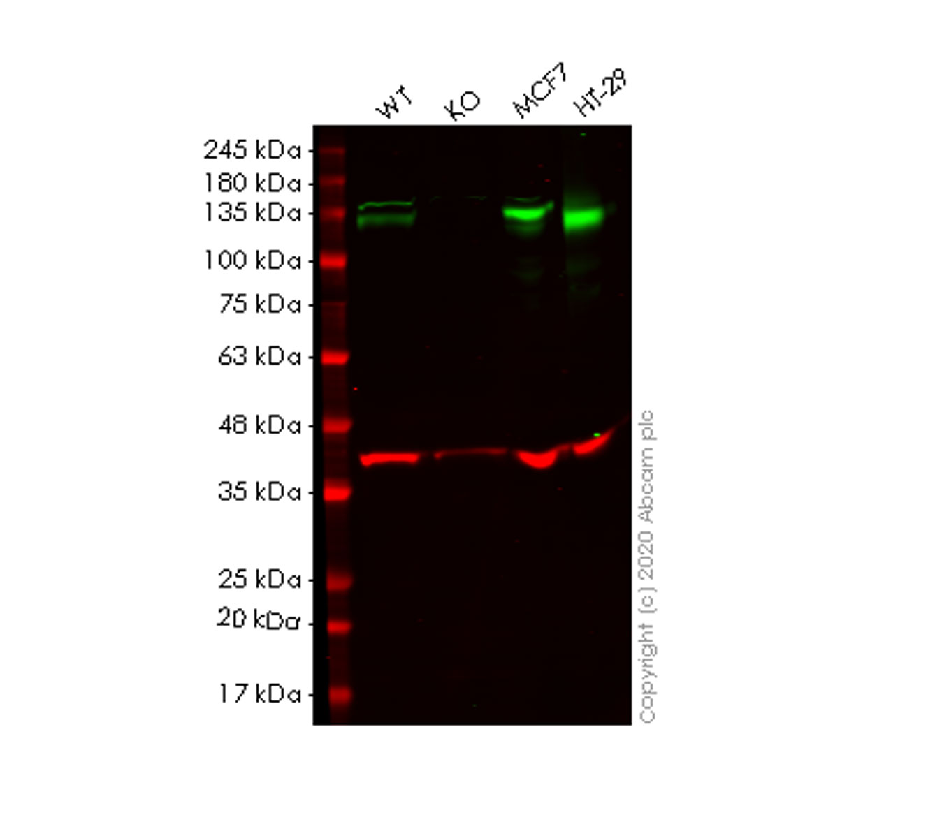 Western blot - Human EPHB4 (Eph receptor B4/HTK) knockout HEK-293T cell line (AB266733), expandable thumbnail
