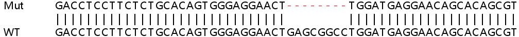Human EPHB4 (Eph receptor B4/HTK) knockout HEK-293T cell lysate