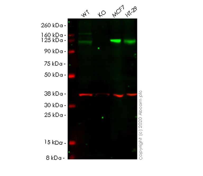 Western blot - Human EPHB4 (Eph receptor B4/HTK) knockout HEK-293T cell lysate (AB257429)