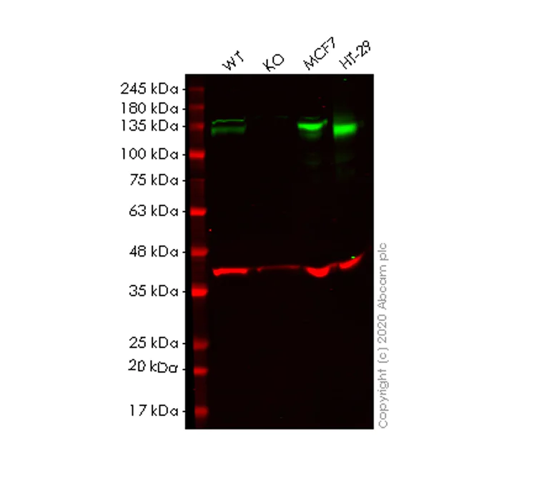 Western blot - Human EPHB4 (Eph receptor B4/HTK) knockout HEK-293T cell lysate (AB257429)