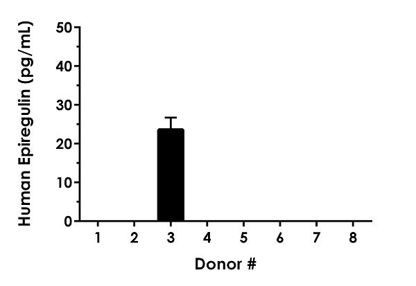 Sandwich ELISA - Human Epiregulin ELISA Kit (EREG) (AB277077)