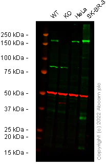 Western blot - Human ErbB2 / HER2 knockout HCT116 cell line (AB286644)