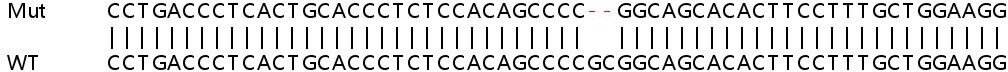 Human ERN1 (IRE1) knockout HeLa cell line