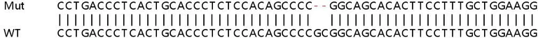 Sanger Sequencing - Human ERN1 (IRE1) knockout HeLa cell line (AB255389)