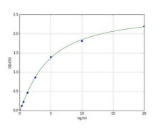 Sandwich ELISA - Human Estrogen Receptor beta ELISA Kit (AB285292)
