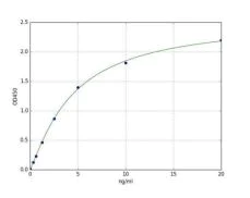 Sandwich ELISA - Human Estrogen Receptor beta ELISA Kit (AB285292)