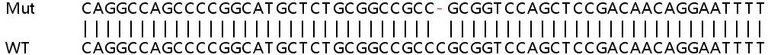 Sanger Sequencing - Human ETNK1 (ethanolamine kinase) knockout HeLa cell lysate (AB263192)