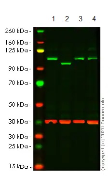 Western blot - Human EXOC2 knockout HeLa cell line (AB265839), expandable thumbnail
