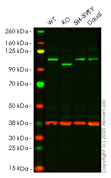 Human EXOC2 knockout HeLa cell lysate