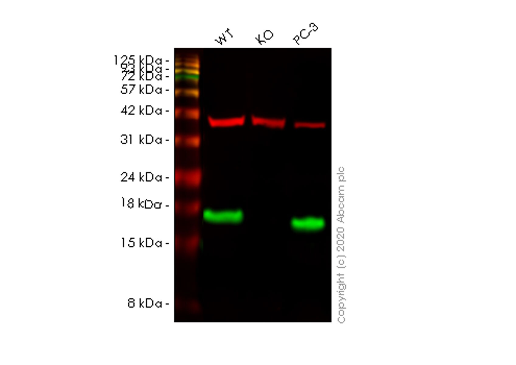 Western blot - Human FABP5 knockout HeLa cell lysate (AB257431), expandable thumbnail
