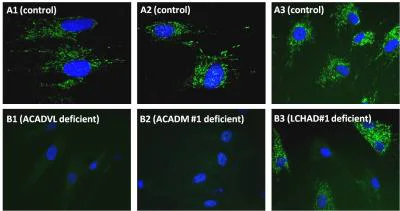Immunocytochemistry - Human Fatty Acid Oxidation In-Cell ELISA Kit (AB118182)