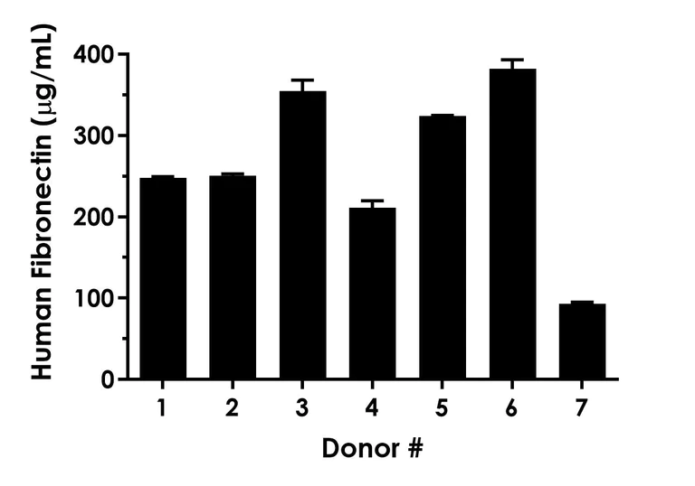 Sandwich ELISA - Human Fibronectin ELISA Kit, Chemiluminescent (AB325445)