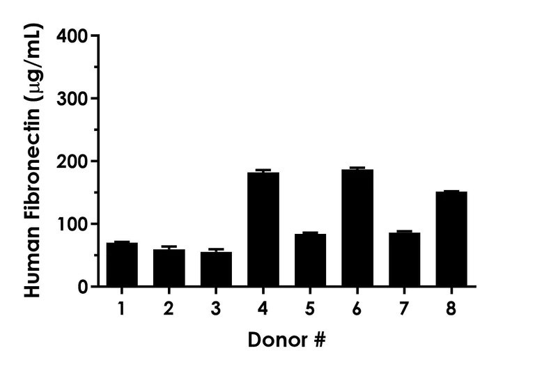 Sandwich ELISA - Human Fibronectin ELISA Kit, Chemiluminescent (AB325445)