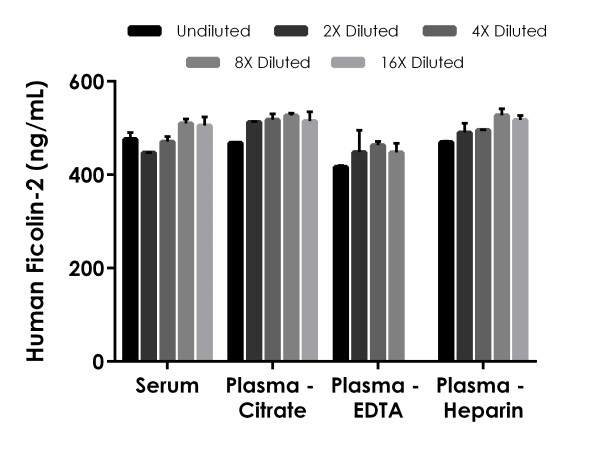 Sandwich ELISA - Human Ficolin-2 ELISA Kit (AB275554)