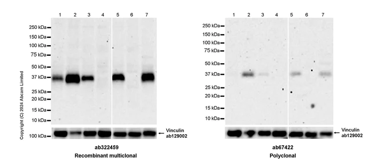 Western blot - Human FOLR1 (Folate Binding Protein/FBP) knockout HeLa cell lysate (AB257270)