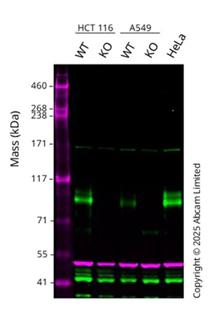 Western blot - Human FOXM1 knockout MCF7 cell line (AB287435)