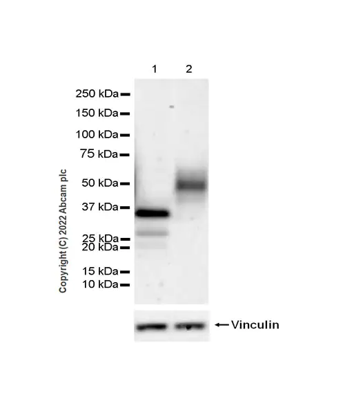 Western blot - Human FTO knockout MCF7 cell line (AB282631), expandable thumbnail