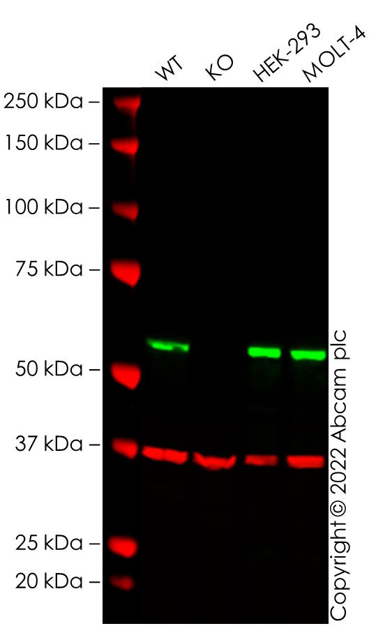 Western blot - Human FTO knockout MCF7 cell line (AB282631), expandable thumbnail