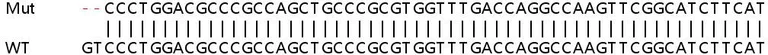 Sanger Sequencing - Human FUCA2 knockout HEK-293T cell lysate (AB263205)