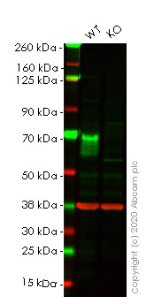 Western blot - Human GBA knockout HeLa cell line (AB265038)