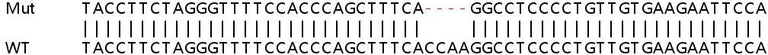 Sanger Sequencing - Human GHITM (MICS1) knockout HEK-293T cell line (AB266480)
