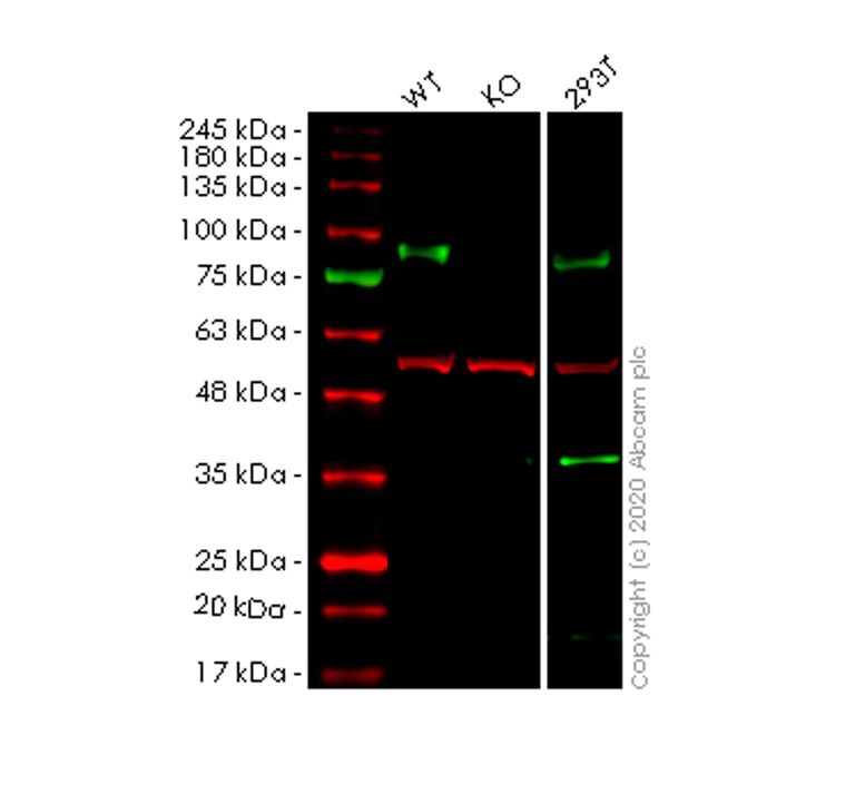 Western blot - Human GNS knockout HeLa cell line (AB265495)