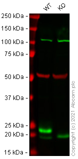knock out glutathione Human GPX1 (Glutathione Peroxidase 1) knockout HEK-293T cell line (ab266650) Frontiers | Nutritional Ketosis