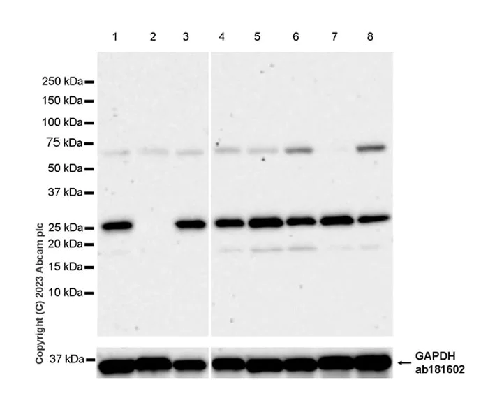 Western blot - Human GRB2 knockout HCT116 cell lysate (AB275248)