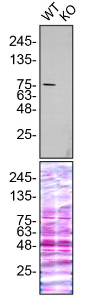 Western blot - Human GSN (Gelsolin) knockout HeLa cell lysate (AB257204), expandable thumbnail