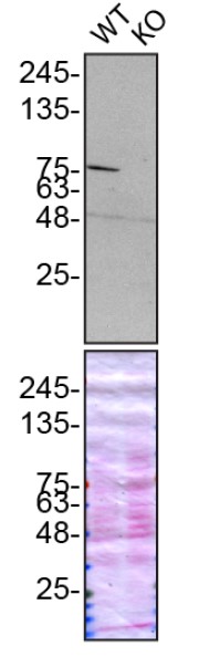 Western blot - Human GSN (Gelsolin) knockout HeLa cell lysate (AB257204), expandable thumbnail