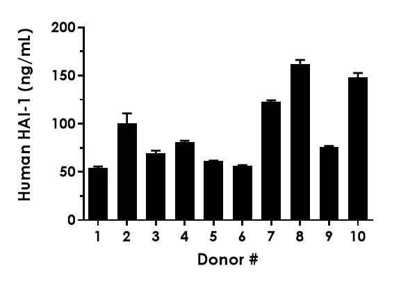 Sandwich ELISA - Human HAI-1 ELISA Kit (AB288176)