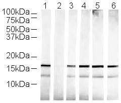 Human Histone H3 (tri methyl K36) peptide
