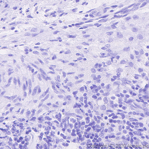 Immunohistochemistry (Formalin/PFA-fixed paraffin-embedded sections) - Human Histone H3.3 (Mutated G34W, G34V, G34R) Antibody Panel (ab274410), expandable thumbnail