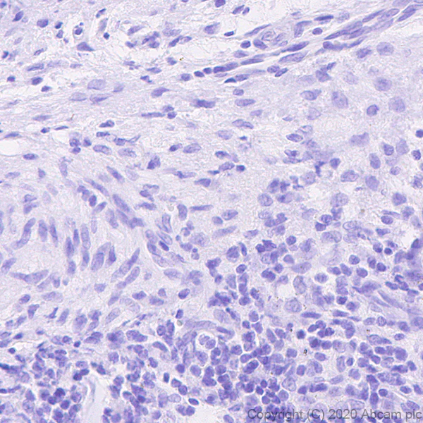 Immunohistochemistry (Formalin/PFA-fixed paraffin-embedded sections) - Human Histone H3.3 (Mutated G34W, G34V, G34R) Antibody Panel (AB274410)