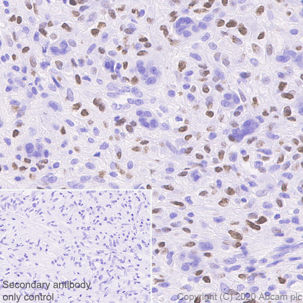 Immunohistochemistry (Formalin/PFA-fixed paraffin-embedded sections) - Human Histone H3.3 (Mutated G34W, G34V, G34R) Antibody Panel (ab274410), expandable thumbnail