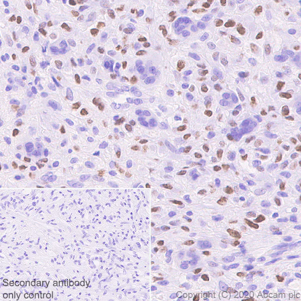Immunohistochemistry (Formalin/PFA-fixed paraffin-embedded sections) - Human Histone H3.3 (Mutated G34W, G34V, G34R) Antibody Panel (AB274410)