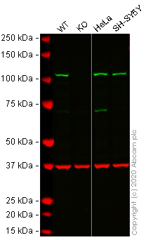 Western blot - Human HK2 (Hexokinase II) knockout HCT116 cell lysate (AB275250), expandable thumbnail