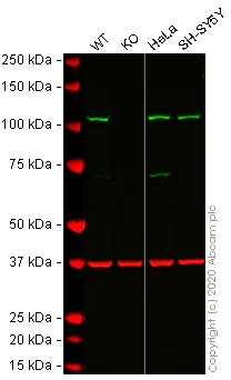 Western blot - Human HK2 (Hexokinase II) knockout HCT116 cell lysate (AB275250)