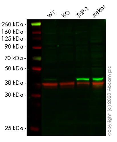 Western blot - Human HLA-E (HLA E) knockout A549 cell lysate (AB258453)