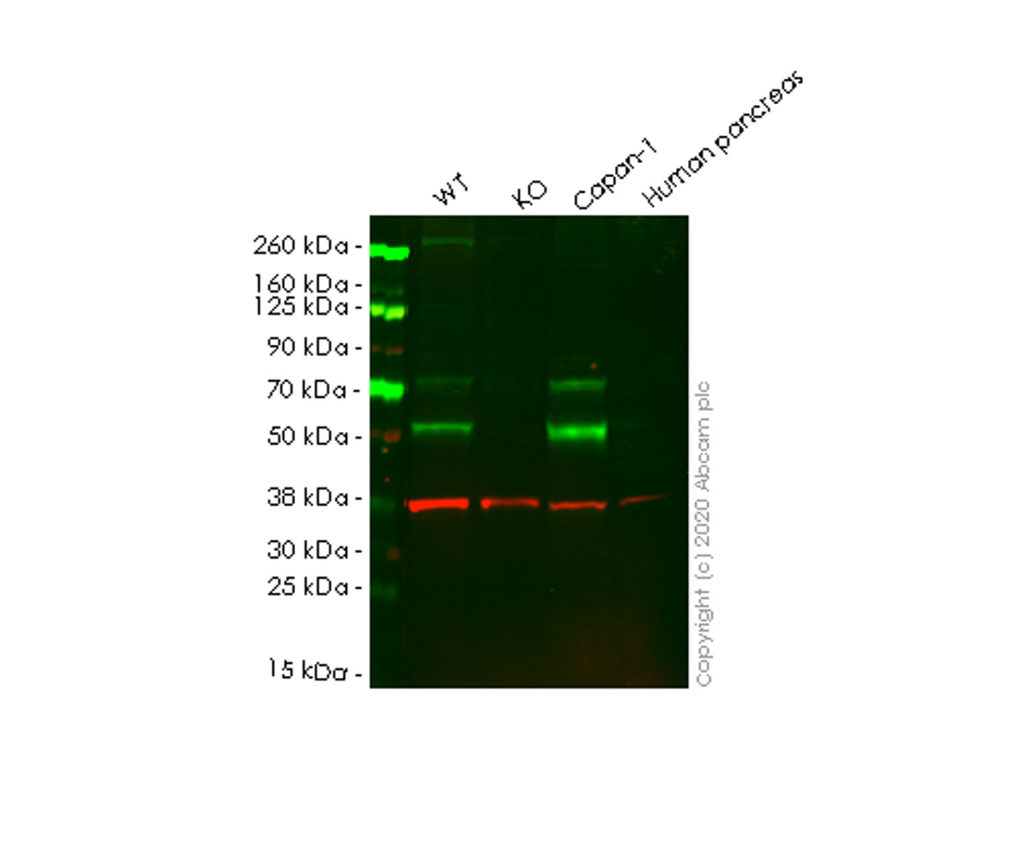 Western blot - Human HPSE (Heparanase 1) knockout HeLa cell line (AB265413), expandable thumbnail