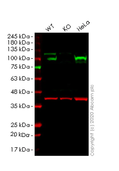 Western blot - Human HSP90B1 (GRP94) knockout HEK-293T cell lysate (AB257254)