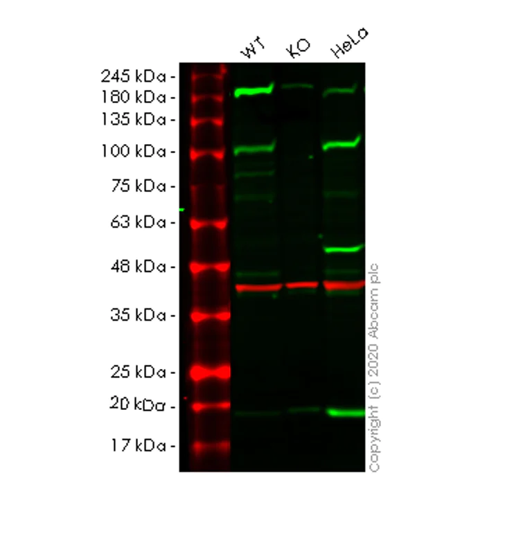 Western blot - Human HSP90B1 (GRP94) knockout HEK-293T cell lysate (AB257254)
