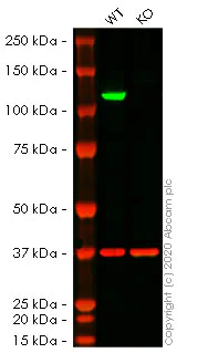 Western blot - Human IDE (Insulin degrading enzyme) knockout HeLa cell line (AB261755)