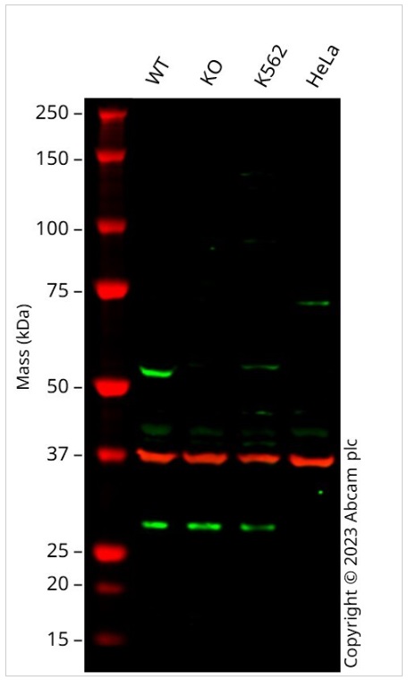 Western blot - Human IFIT1 knockout A549 cell line (AB266957), expandable thumbnail