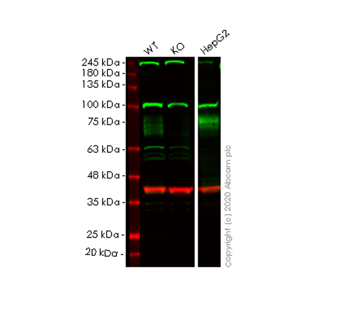 Western blot - Human IFNGR1 knockout HeLa cell line (AB265111), expandable thumbnail