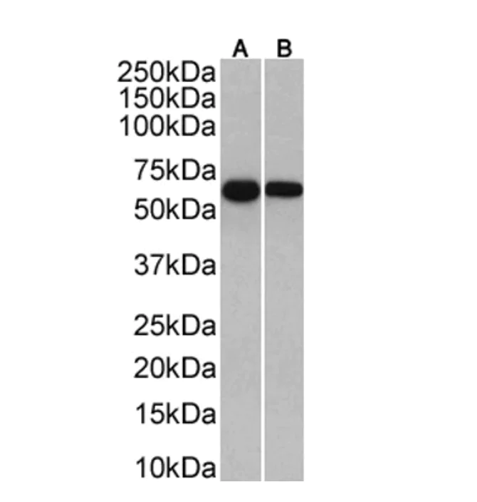 Western blot - Anti-Human IgA Antibody [15D6] (AB316358)