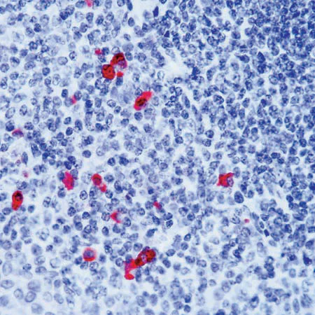 Immunohistochemistry (Formalin/PFA-fixed paraffin-embedded sections) - Anti-Human IgA antibody (AB2411)