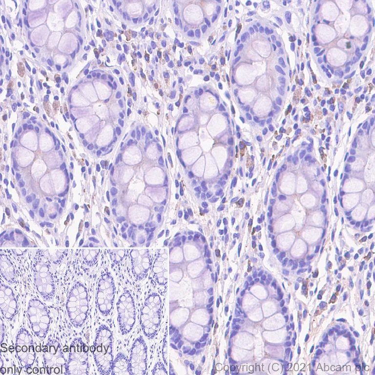 Immunohistochemistry (Formalin/PFA-fixed paraffin-embedded sections) - Anti-Human IgA antibody [EPSISR10] (AB133660)