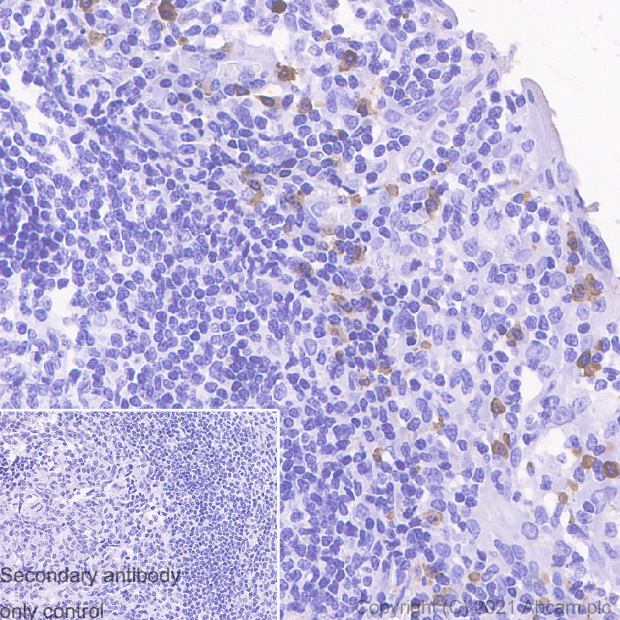 Immunohistochemistry (Formalin/PFA-fixed paraffin-embedded sections) - Anti-Human IgA antibody [EPSISR10] (AB133660)